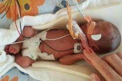 Prematüre Bebek Nedir? 1 Prematüre Bebek Nedir? - 9240988 3X2 700X467